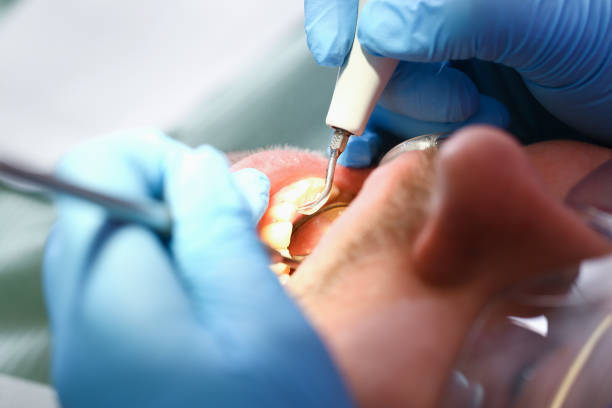 Best Emergency Gum Treatment in Wolfe City, TX