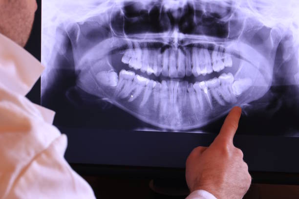 Best Emergency Denture Repair in Wolfe City, TX