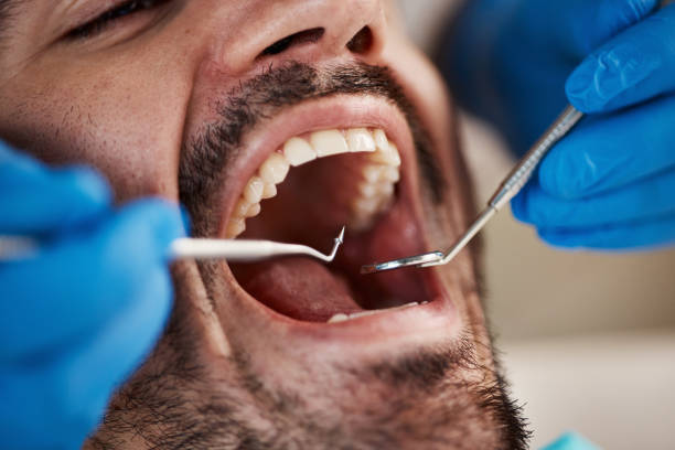 Best Urgent Care for Lost Fillings or Crowns in Wolfe City, TX